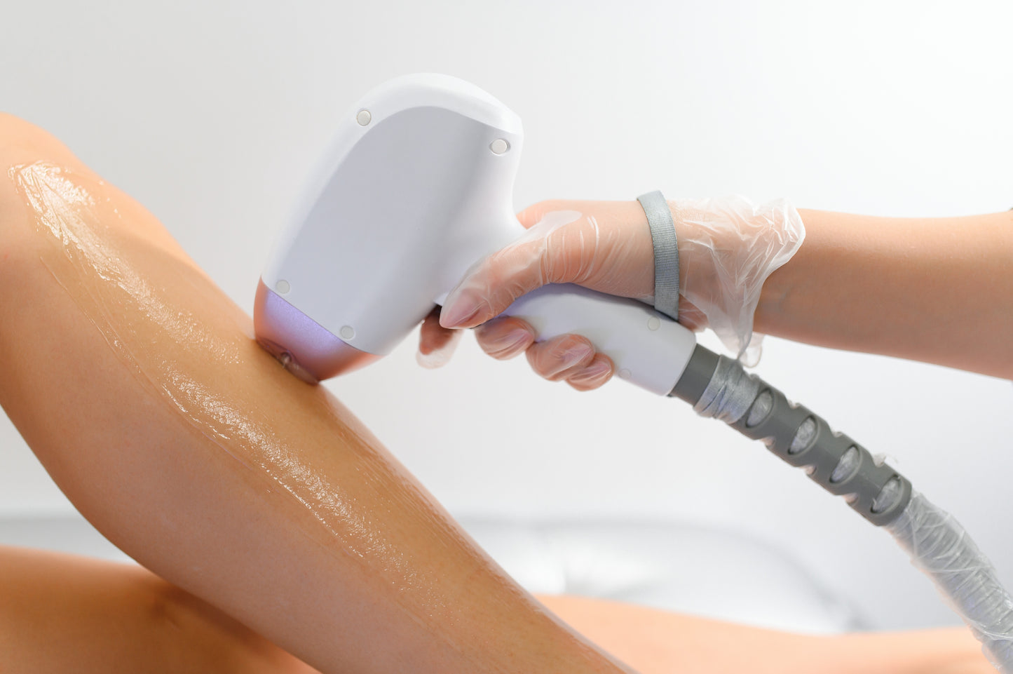 Laser Hair Removal - 3 Zones Package (6 Sessions)